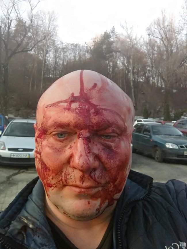 Скандально известного догхантера Святогора жестоко избили в Киеве 01