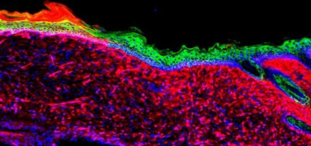 Новую кожу смогли вырастить на открытой ране
