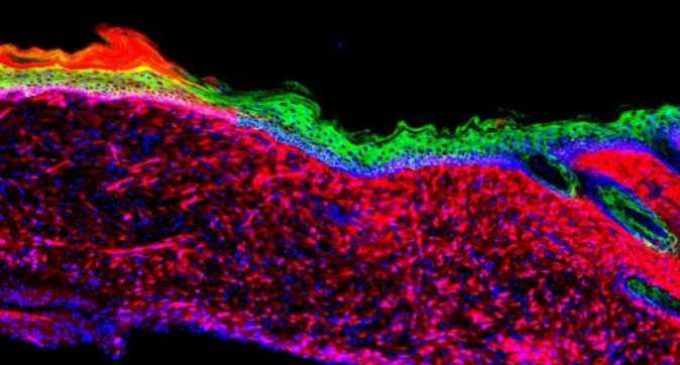 Новую кожу смогли вырастить на открытой ране