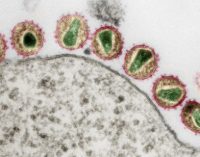 Обнаружен последний фрагмент для создания вакцины от ВИЧ