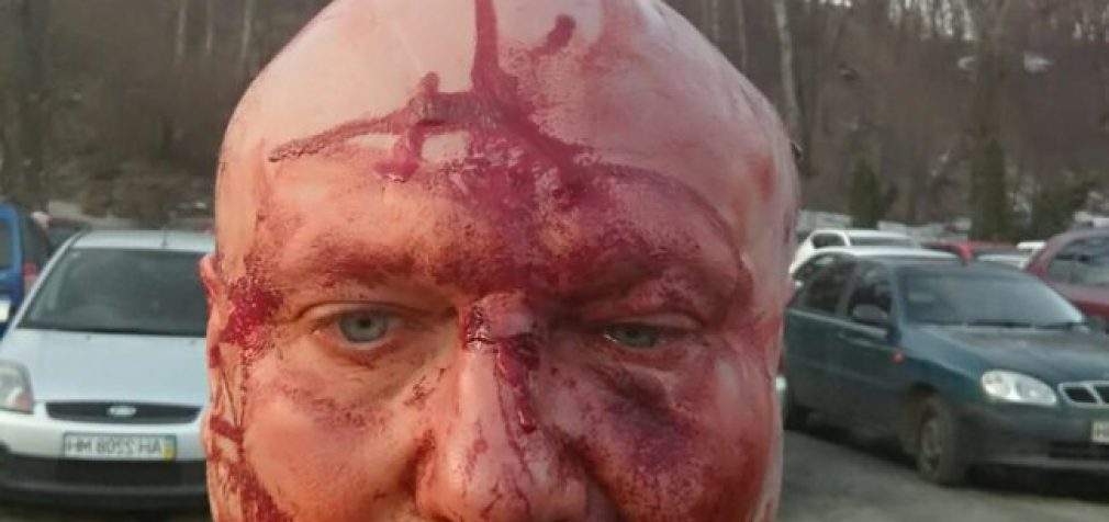Скандально известного догхантера Святогора жестоко избили в Киеве. ФОТО