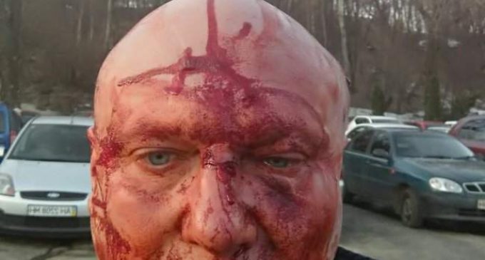 Скандально известного догхантера Святогора жестоко избили в Киеве. ФОТО