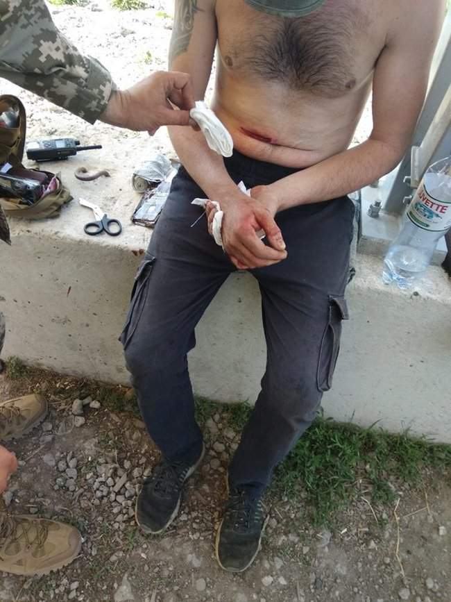 На КПВВ Гнутово пограничники оказали помощь мужчине, раненому при побеге с блокпоста наемников РФ 01