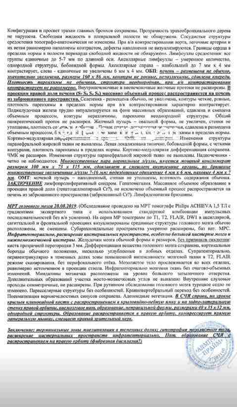 Полуторагодовалому Марьяну Коберскому нужна помощь в лечении онкозаболевания 03