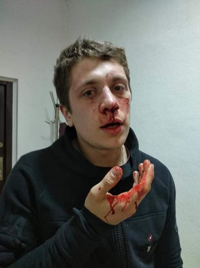 Неизвестные в балаклавах избили активистов в Днепре: есть травмы черепа, челюсти и носа 01