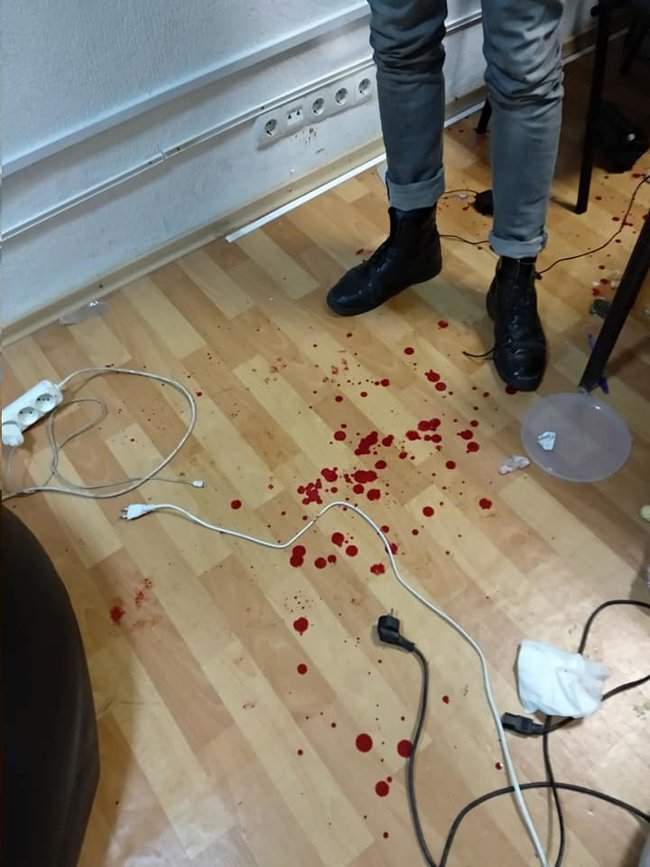 Неизвестные в балаклавах избили активистов в Днепре: есть травмы черепа, челюсти и носа 02