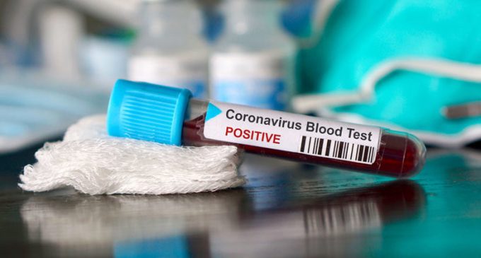 480 случаев инфицирования COVID-19: новая статистика по коронавирусу в Украине
