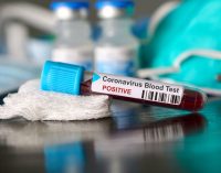 В Днепре и области еще 8 человек заразились коронавирусом: новая статистика COVID-19 по Днепропетровщине