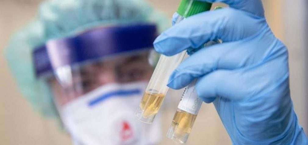 Коронавирус в Днепре: свежая статистика на вечер 29 апреля