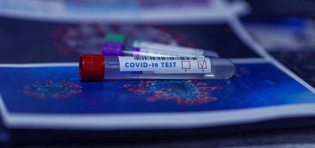 14710 случаев инфицирования COVID-19: статистика по коронавирусу в Украине на 9 мая