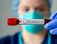Большинство больных COVID-19 жителей Днепропетровской области находятся в легком состоянии, – ДнепрОГА