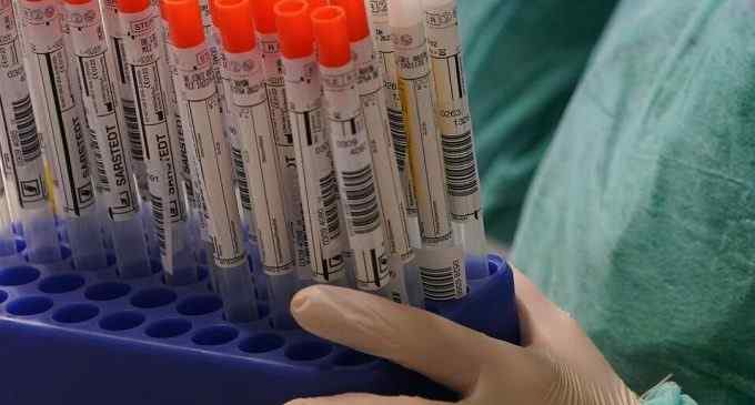 Обновленные данные: где и за сколько можно пройти тест на коронавирус в Днепре