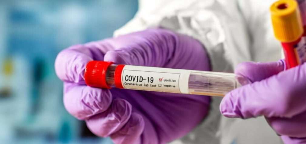 Более сотни заболевших: статистика по COVID-19 в Днепре на утро 19 февраля