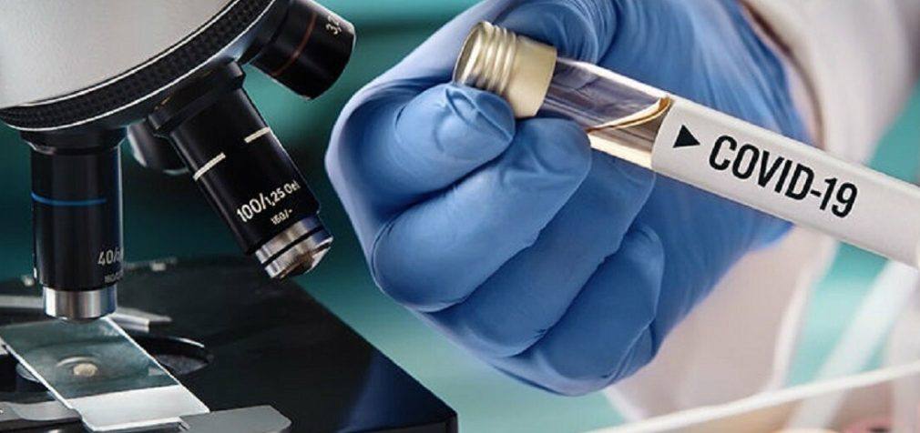 Коронавирус в Украине: Статистика по COVID-19 на утро 30 марта по областям