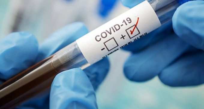 Более двух сотен за сутки: статистика по COVID-19 в Днепре на утро 10 марта