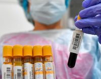 Снова около пятисот больных: статистика по COVID-19 в Днепре на утро 25 марта