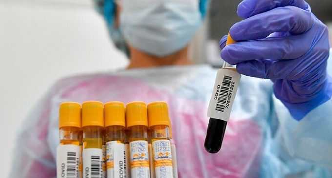 Снова около пятисот больных: статистика по COVID-19 в Днепре на утро 25 марта