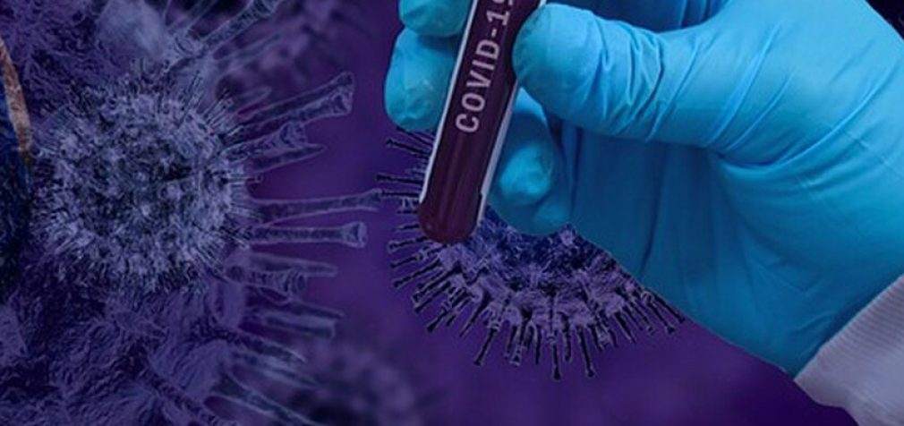Девять летальных случаев: статистика по COVID-19 в Днепре на утро 31 марта