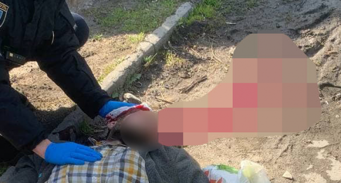 В центре Днепра у мужчины случился приступ: полиция спасала пострадавшего
