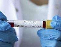 Коронавирус в Украине 2 апреля: почти 20 тысяч больных за сутки