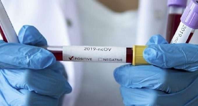 Коронавирус в Украине 2 апреля: почти 20 тысяч больных за сутки