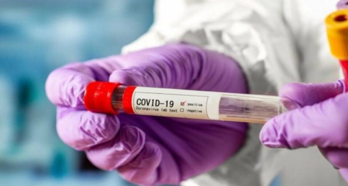 367 новых случаев инфицирования: статистика по COVID-19 в Днепре на утро 23 апреля