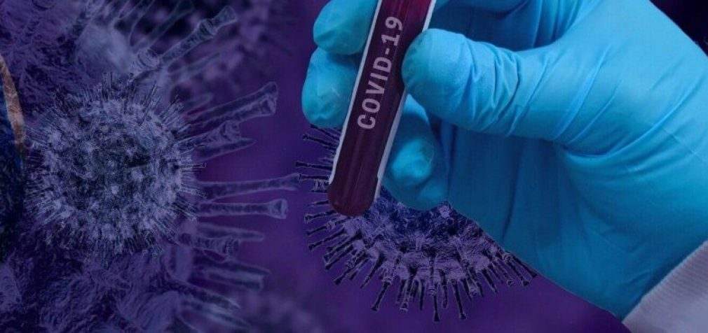 182 новых случая инфицирования: статистика по COVID-19 в Днепре на утро 13 мая