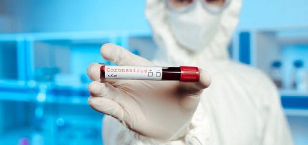 146 новых случаев инфицирования: статистика по COVID-19 в Днепре на утро 14 мая