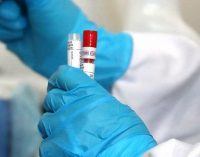 20 новых случаев инфицирования: статистика по COVID-19 в Днепре на утро 22 июня