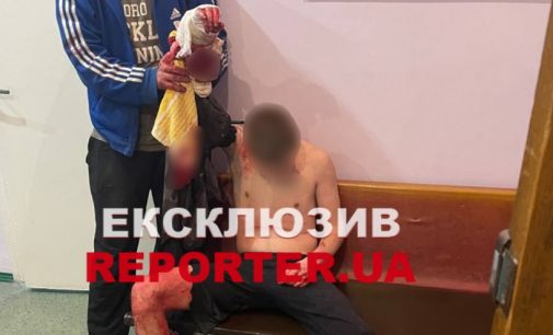 Сварився з бабусею: В Дніпрі п’яний чоловік ледь не втратив руку