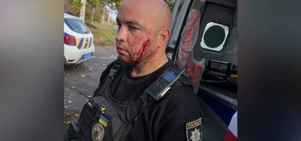 Напав на поліцейського з ножем: 32-річному жителю Дніпропетровщини загрожує довічне увʼязнення