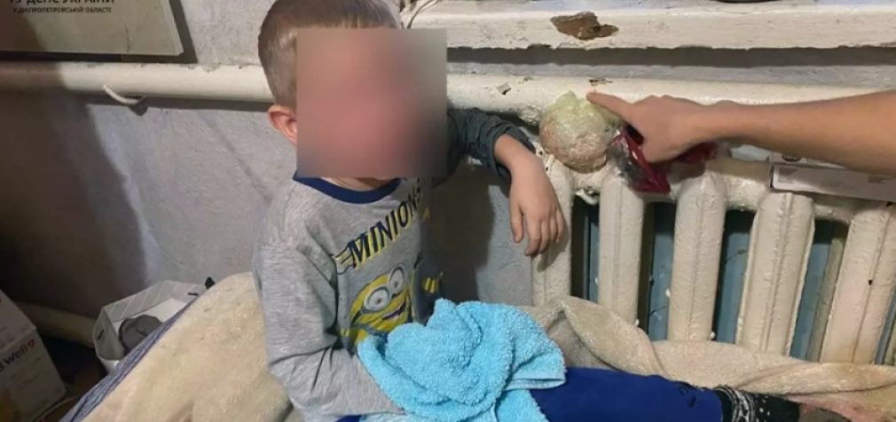У Дніпрі хлопчик застряг рукою в батареї опалення