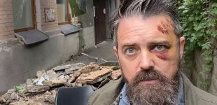 У Києві на американського режисера обвалився балкон