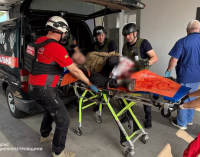 Травматична ампутація кінцівки: ворог вчергове обстріляв мирних жителів Нікополя
