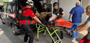 Травматична ампутація кінцівки: ворог вчергове обстріляв мирних жителів Нікополя