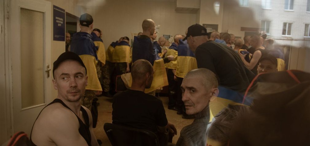 Випалили “Слава Росії”: фото тортур українського військового справжнє – ГУР