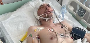 Помер чоловік з Волині, який після мобілізації опинився в реанімації
