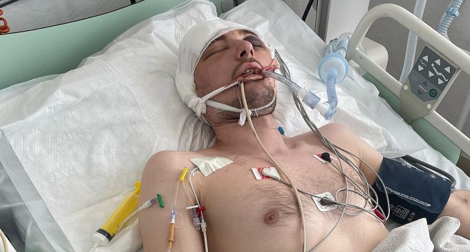 Помер чоловік з Волині, який після мобілізації опинився в реанімації